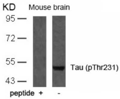 Western Blot: Tau [p Thr231] Antibody [NB100-82249]